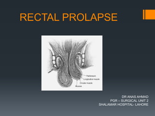 RECTAL PROLAPSE
DR ANAS AHMAD
PGR – SURGICAL UNIT 2
SHALAMAR HOSPITAL- LAHORE
 
