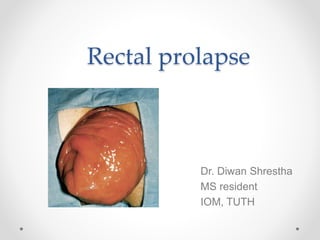 Rectal prolapse
Dr. Diwan Shrestha
MS resident
IOM, TUTH
 