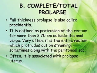Proclusive RECTAL_PROLAPSE.pdf