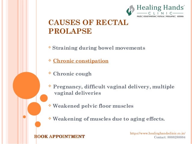 Rectal Prolapse Causes Symptoms And Treatment