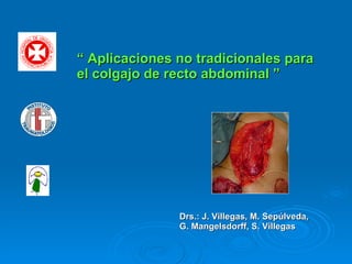   “  Aplicaciones no tradicionales para el colgajo de recto abdominal ” Drs.: J. Villegas, M. Sepúlveda, G. Mangelsdorff, S. Villegas 