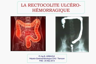 LA RECTOCOLITE ULCÉRO-
HÉMORRAGIQUE
Pr Ag B. ARBAOUI
Hépato-Gastroentérologue CHU Tlemcen
FMC 25 Mai 2013
 