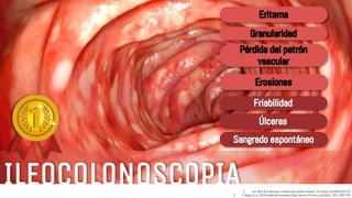 Rectocolitis ulcerativa | PPTX