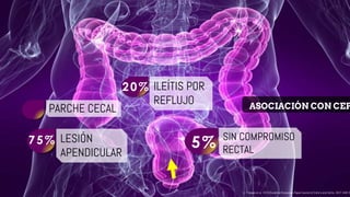 Rectocolitis ulcerativa | PPTX