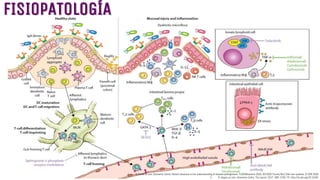 FISIOPATOLOGÍA
1. R. Porter et cols. Ulcerative Colitis: Recent advances in the undersatanding of disease pathogenesis. F1000Research 2020, 9(F1000 Faculty Rev):294 Last updated: 27 APR 2020
2. R. Ungaro et cols. Ulcerative Colitis. The Lancet. 2017. 389: 1756–70. http://dx.doi.org/10.1016/
 