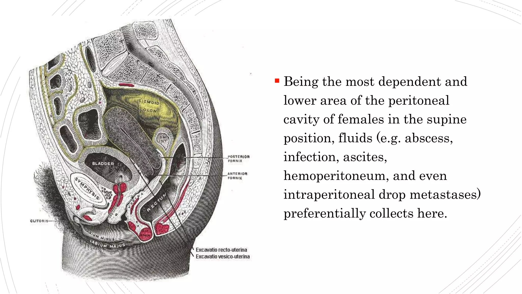 Rectouterine Pouch.pptx