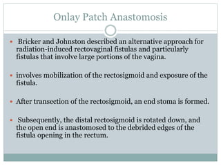 Onlay Patch Anastomosis
 Bricker and Johnston described an alternative approach for
radiation-induced rectovaginal fistulas and particularly
fistulas that involve large portions of the vagina.
 involves mobilization of the rectosigmoid and exposure of the
fistula.
 After transection of the rectosigmoid, an end stoma is formed.
 Subsequently, the distal rectosigmoid is rotated down, and
the open end is anastomosed to the debrided edges of the
fistula opening in the rectum.
 