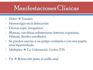 

Dolor  Tensión
Hemorragia en la defecación
Úlceras rojas, irregulares
Blancas, con fibras esfinterianas internas expuestas,
Fibrosis, Bordes enrollados
Se pueden asociar a un pólipo centinela o con una papila
anal hipertrofiada
Múltiples  Ca. Colorrectal, Crohn, ETS



Dx  Retracción junto al anillo anal








 