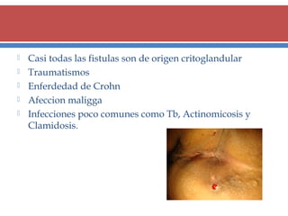 





Casi todas las fistulas son de origen critoglandular
Traumatismos
Enferdedad de Crohn
Afeccion maligga
Infecciones poco comunes como Tb, Actinomicosis y
Clamidosis.

 