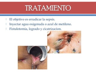 



El objetivo es erradicar la sepsis.
Inyectar agua oxigenada o azul de metileno.
Fistulotomia, legrado y cicatrizacion.

 
