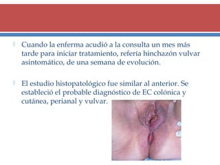 

Cuando la enferma acudió a la consulta un mes más
tarde para iniciar tratamiento, refería hinchazón vulvar
asintomático, de una semana de evolución.



El estudio histopatológico fue similar al anterior. Se
estableció el probable diagnóstico de EC colónica y
cutánea, perianal y vulvar.

 