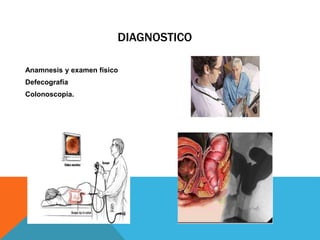 DIAGNOSTICO
Anamnesis y examen físico
Defecografía
Colonoscopia.
 
