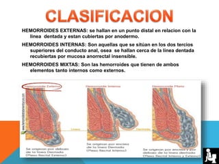HEMORROIDES EXTERNAS: se hallan en un punto distal en relacion con la
linea dentada y estan cubiertas por anodermo.
HEMORROIDES INTERNAS: Son aquellas que se sitúan en los dos tercios
superiores del conducto anal, osea se hallan cerca de la linea dentada
recubiertas por mucosa anorrectal insensible.
HEMORROIDES MIXTAS: Son las hemorroides que tienen de ambos
elementos tanto internos como externos.
 