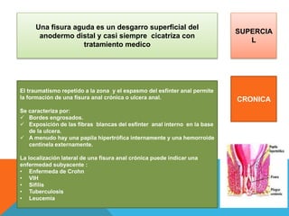 Una fisura aguda es un desgarro superficial del
anodermo distal y casi siempre cicatriza con
tratamiento medico
El traumatismo repetido a la zona y el espasmo del esfínter anal permite
la formación de una fisura anal crónica o ulcera anal.
Se caracteriza por:
 Bordes engrosados.
 Exposición de las fibras blancas del esfínter anal interno en la base
de la ulcera.
 A menudo hay una papila hipertrófica internamente y una hemorroide
centinela externamente.
La localización lateral de una fisura anal crónica puede indicar una
enfermedad subyacente :
• Enfermeda de Crohn
• VIH
• Sifilis
• Tuberculosis
• Leucemia
SUPERCIA
L
CRONICA
 