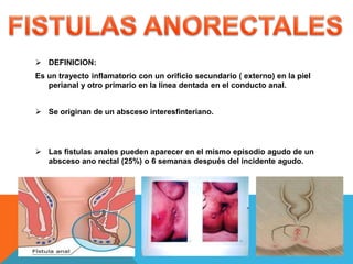  DEFINICION:
Es un trayecto inflamatorio con un orificio secundario ( externo) en la piel
perianal y otro primario en la línea dentada en el conducto anal.
 Se originan de un absceso interesfinteriano.
 Las fistulas anales pueden aparecer en el mismo episodio agudo de un
absceso ano rectal (25%) o 6 semanas después del incidente agudo.
 