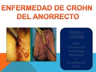 Signos y
síntomas
Dolor
Tumefacción
Hemorragia
Manchado
o
Incontinencia
Fiebre
 