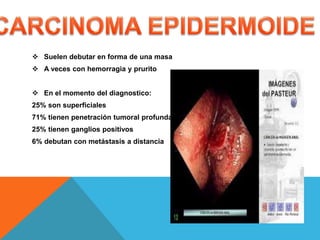  Suelen debutar en forma de una masa
 A veces con hemorragia y prurito
 En el momento del diagnostico:
25% son superficiales
71% tienen penetración tumoral profunda
25% tienen ganglios positivos
6% debutan con metástasis a distancia
 