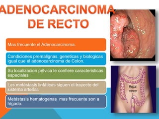 Mas frecuente el Adenocarcinoma.
Condiciones premalignas, geneticas y biologicas
igual que el adenocarcinoma de Colon.
Su localizacion pélvica le confiere caracteristicas
especiales
Las metástasis linfáticas siguen el trayecto del
sistema arterial.
Metástasis hematogenas mas frecuente son a
hígado.
 