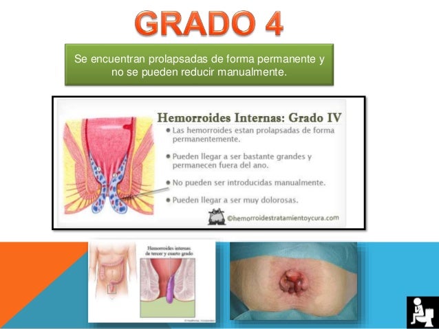 Patología De Ano Y Recto