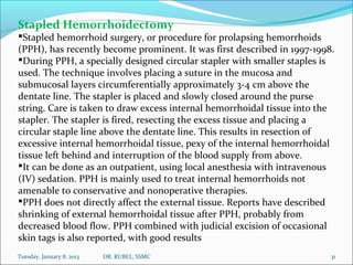 Stapled Hemorrhoidectomy
Stapled hemorrhoid surgery, or procedure for prolapsing hemorrhoids
(PPH), has recently become p...