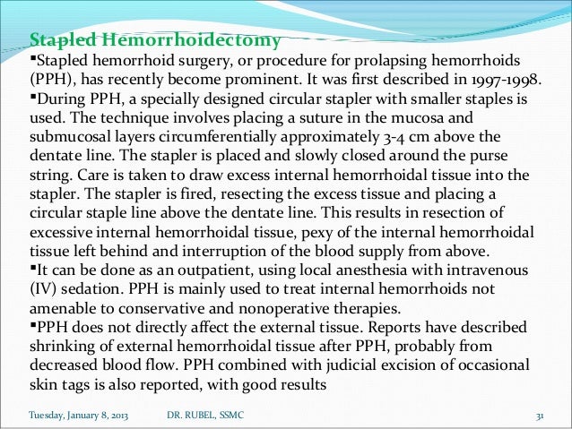 before and after stapled hemorrhoidectomy before and after stapled hemorrhoidectomy