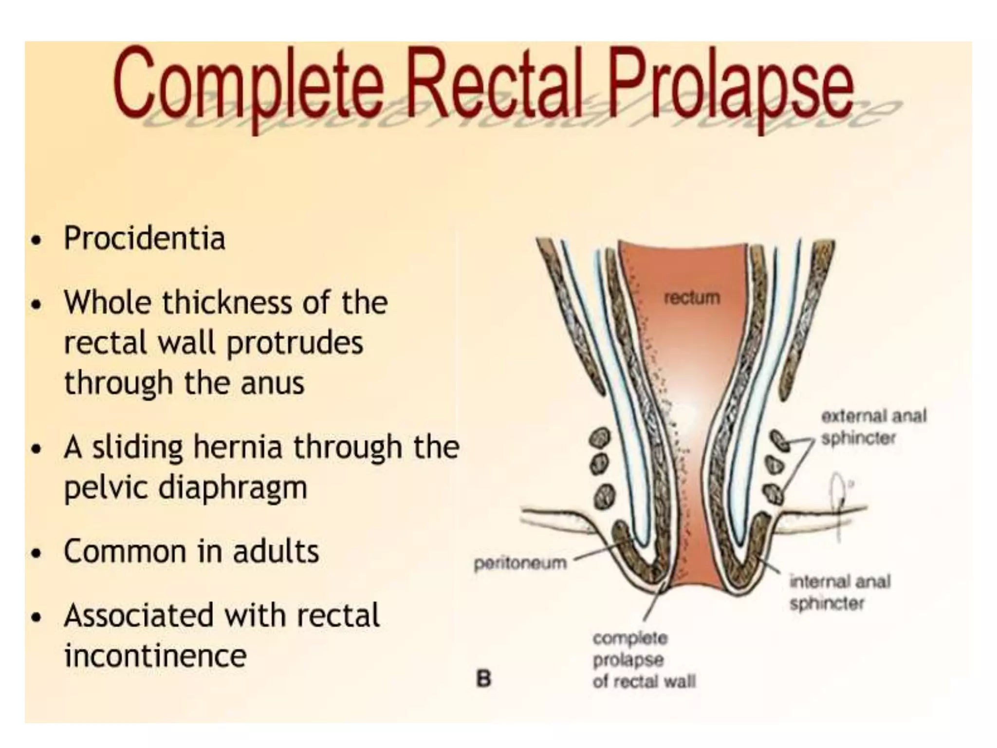 Anatomy of Rectum.pptx