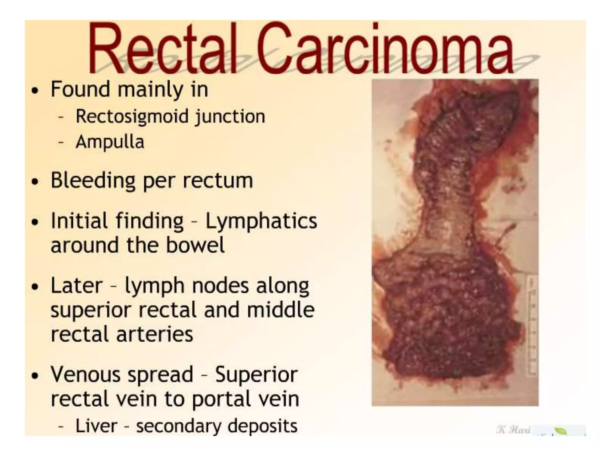 Anatomy of Rectum.pptx
