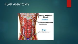 Rectus abdominis flap | PPTX