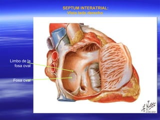 SEPTUM INTERATRIAL: Vista lado derecho Limbo de la fosa oval Fosa oval 