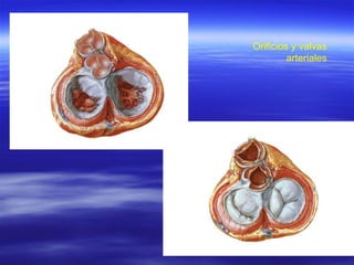 Orificios y valvas arteriales 
