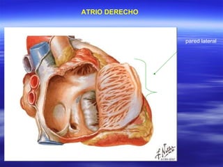 ATRIO DERECHO pared lateral 