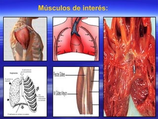 Músculos de interés:   