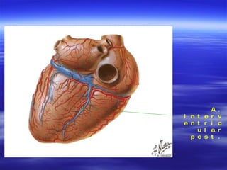 A. Interventricular post. 