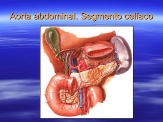 Aorta abdominal. Segmento celíaco 