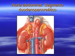 Aorta abdominal. Segmento duodenopancreático 