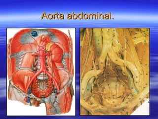 Aorta abdominal.  