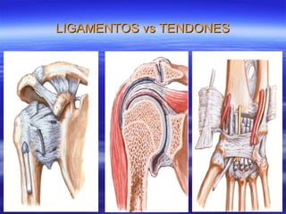 LIGAMENTOS vs TENDONES 