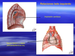 Relaciones lado izquierdo Impresión cardíaca Nervio frénico y vasos pericardiofrénicos izq. 