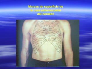 Marcas de superficie de la cara esternocostal del corazón 