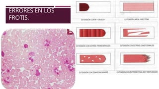 ERRORES EN LOS
FROTIS.
 