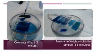 Colorante Wright (1
minuto).
Mezcla de Wright y solución
tampón (3-5 minutos).
 