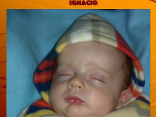IGNACIO 
 