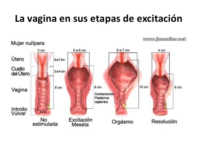 Por qué un pequeño miembro y como corregirle