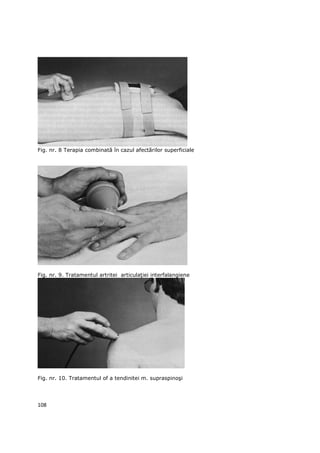 Fig. nr. 8 Terapia combinată în cazul afectărilor superficiale




Fig. nr. 9. Tratamentul artritei articulaŃiei interfalangiene




Fig. nr. 10. Tratamentul of a tendinitei m. supraspinoşi




108
 