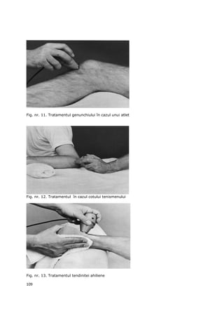 Fig. nr. 11. Tratamentul genunchiului în cazul unui atlet




Fig. nr. 12. Tratamentul în cazul cotului tenismenului




Fig. nr. 13. Tratamentul tendinitei ahiliene

109
 