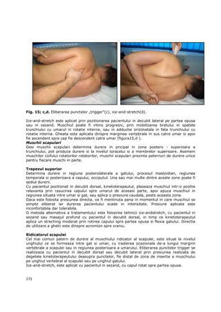 Fig. 15; c,d. Eliberarea punctelor „trigger”(c), ice-and-stretch(d).

Ice-and-stretch este aplicat prin pozitionarea pacientului in decubit lateral pe partea opusa
sau in sezand. Muschiul poate fi intins progresiv, prin mobilizarea bratului in spatele
trunchiului cu umarul in rotatie interna, sau in adductie orizonatala in fata trunchiului cu
rotatie interna. Gheata este aplicata dinspre marginea vertebrala in sus catre umar si apoi
fie ascendent spre cap fie descendent catre umar (figura15,d ).
Muschii scapulari
Desi muschii scapulari determina durere in pricipal in zona postero - superioara a
trunchiului, pot produce durere si la nivelul toracelui si a membrelor superioare. Asemeni
muschilor coifului rotatorilor rotatorilor, muschii scapulari prezinta paternuri de durere unice
pentru fiecare muschi in parte.

Trapezul superior
Determina durere in regiune posterolaterala a gatului, procesul mastoidian, regiunea
temporala si posterioara a capului, occiputul. Una sau mai multe dintre aceste zone poate fi
sediul durerii.
Cu pacientul pozitionat in decubit dorsal, kinetoterapeutul, plaseaza muschiul intr-o pozitie
relaxanta prin rasucirea capului spre umarul de aceeasi parte, apoi apuca muschiul in
regiunea situata intre umar si gat, sau aplica o presiune caudala, peste aceasta zona.
Daca este folosita presiunea directa, va fi mentinuta pana in momentul in care muschiul se
simpte eliberat iar durerea pacientului scade in intensitate. Presiune aplicata este
inconfortabila dar tolerabila.
O metoda alternativa a tratamentului este folosirea tehnicii ice-andstretch, cu pacientul in
sezand sau masajul profund cu pacientul in decubit dorsal, in timp ce kinetoterapeutul
aplica un streching moderat prin rotirea capului spre partea opusa si flexia gatului. Directia
de utilizare a ghetii este dinspre acromion spre craniu.

Ridicatorul scapulei
Cel mai comun patern de durere al muschiului ridicator al scapulei, este situat la nivelul
unghiului ce se formeaza intre gat si umar, cu iradierea ocazionala de-a lungul marginii
vertebrale a scapulei sau in regiunea posterioara a umarului. Eliberarea punctelor trigger se
realizeaza cu pacientul in decubit dorsal sau decubit lateral prin presiunea realizata de
degetele kinetoterapeutului deasupra punctelor, fie distal de zona de insertie a muschiului
pe unghiul vertebral al scapulei sau pe unghiul gatului.
Ice-and-stretch, este aplicat cu pacientul in sezand, cu capul rotat spre partea opusa.


171
 