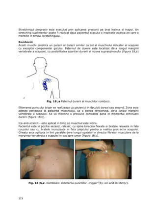 Stretchingul progresiv este executat prin aplicarea presiunii pe brat inainte si inapoi. Un
stretching suplimentar poate fi realizat daca pacientul executa o inspiratie adanca pe care o
mentine in timpul stretchingului.

Romboizii
Acesti muschi prezinta un patern al durerii similar cu cel al muschiului ridicator al scapulei
cu exceptia componentei gatului. Paternul de durere este localizat de-a lungul marginii
vertebrale a scapulei, cu posibilitatea aparitiei durerii si inzona supraspinosului (figura 18,a)
.




                      Fig. 18 ;a Paternul durerii al muschilor romboizi.

Eliberarea punctului triger se realizeaza cu pacientul in decubit dorsal sau sezand. Zona este
adesea perceputa la palparea muschiului, ca o banda tensionata, de-a lungul marginii
vertebrale a scapulei. Se va mentine o presiune constanta pana in momentul diminuarii
durerii (figura 18,b).

Ice-and-stretch - este aplicat in timp ce muschiul este intins.
Pacientul este in pozitia sezand, relaxat, cu spina toracala flexata si bratele relaxate in fata
corpului sau cu bratele incrucisate in fata pieptului pentru a realiza protractia scapulei.
Gheata este aplicata in linii paralele de-a lungul spatelui in directia fibrelor musculare de la
marginea vertebrala a scapulei in sus spre umar (figura 18,c).




        Fig. 18 ;b,c. Romboizii: eliberarea punctelor „trigger”(b), ice-and-stretch(c).




173
 