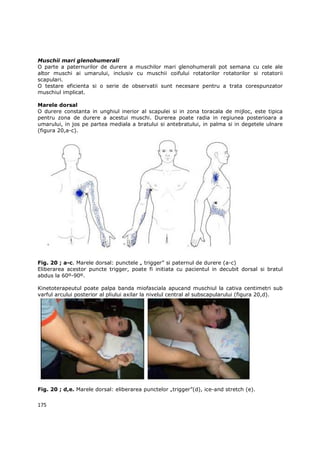 Muschii mari glenohumerali
O parte a paternurilor de durere a muschilor mari glenohumerali pot semana cu cele ale
altor muschi ai umarului, inclusiv cu muschii coifului rotatorilor rotatorilor si rotatorii
scapulari.
O testare eficienta si o serie de observatii sunt necesare pentru a trata corespunzator
muschiul implicat.

Marele dorsal
O durere constanta in unghiul inerior al scapulei si in zona toracala de mijloc, este tipica
pentru zona de durere a acestui muschi. Durerea poate radia in regiunea posterioara a
umarului, in jos pe partea mediala a bratului si antebratului, in palma si in degetele ulnare
(figura 20,a-c).




Fig. 20 ; a-c. Marele dorsal: punctele „ trigger” si paternul de durere (a-c)
Eliberarea acestor puncte trigger, poate fi initiata cu pacientul in decubit dorsal si bratul
abdus la 60º-90º.

Kinetoterapeutul poate palpa banda miofasciala apucand muschiul la cativa centimetri sub
varful arcului posterior al pliului axilar la nivelul central al subscapularului (figura 20,d).




Fig. 20 ; d,e. Marele dorsal: eliberarea punctelor „trigger”(d), ice-and stretch (e).

175
 