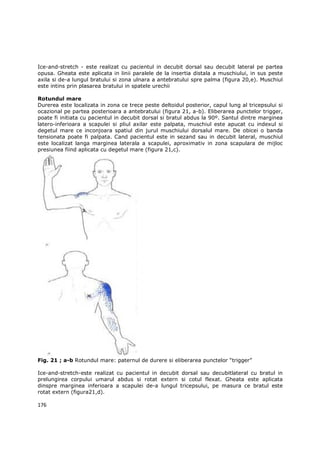 Ice-and-stretch - este realizat cu pacientul in decubit dorsal sau decubit lateral pe partea
opusa. Gheata este aplicata in linii paralele de la insertia distala a muschiului, in sus peste
axila si de-a lungul bratului si zona ulnara a antebratului spre palma (figura 20,e). Muschiul
este intins prin plasarea bratului in spatele urechii

Rotundul mare
Durerea este localizata in zona ce trece peste deltoidul posterior, capul lung al tricepsului si
ocazional pe partea posterioara a antebratului (figura 21, a-b). Eliberarea punctelor trigger,
poate fi initiata cu pacientul in decubit dorsal si bratul abdus la 90º. Santul dintre marginea
latero-inferioara a scapulei si pliul axilar este palpata, muschiul este apucat cu indexul si
degetul mare ce inconjoara spatiul din jurul muschiului dorsalul mare. De obicei o banda
tensionata poate fi palpata. Cand pacientul este in sezand sau in decubit lateral, muschiul
este localizat langa marginea laterala a scapulei, aproximativ in zona scapulara de mijloc
presiunea fiind aplicata cu degetul mare (figura 21,c).




Fig. 21 ; a-b Rotundul mare: paternul de durere si eliberarea punctelor “trigger”

Ice-and-stretch-este realizat cu pacientul in decubit dorsal sau decubitlateral cu bratul in
prelungirea corpului umarul abdus si rotat extern si cotul flexat. Gheata este aplicata
dinspre marginea inferioara a scapulei de-a lungul tricepsului, pe masura ce bratul este
rotat extern (figura21,d).

176
 