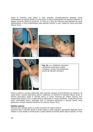 mesei si membrul este abdus in plan scapular. Kinetoterapeutul plaseaza mana
stabilizatoare pe partea distala a humerusului si mana mobilizatoare pe aspectul posterior al
capului humeral, distal de acromion. In timp ce o forta de tractiune este aplicata de mana
stabilizatoare, o forta mobilizatoare este aplicata anterior si usor medial de mana proximala
(figura 32,a).




                                          Fig. 32 ; a-c. Mobilizari articulare -
                                          alunecarea anterioara, pozitia
                                          initiala(a), pozitia intermediara(b),
                                          pozitia de decubit ventral(c)




Pentru a obtine o miscare aditionala, desi restrictia capsulei anteroinferioara se mentine, se
poate folosi o pozitie alternativa pentru mobilizare cu membrul in elevatie (figura 32,b). O
tehnica alternativa poate fi utilizata pentru a creste miscarea de rotatie externa, prin
pozitionarea bratului intr-o rotatie externa aditionala in timpul mobilizarii. O alta tehnica mai
putin confortabila pentru specialist este cu pacientul pozitionat in decubit dorsal, forta
aplicandu-s dinspre aspectul posterior al umarului (figura 32,c).

Rotatia externa
Tehnica este utilizata pentru a creste miscarea de rotatie externa.
Pacientul este in decubit dorsal cu bratul abdus in plan scapular, specialistul plaseaza mana
distala in zona distala a humerusului si podul palmei proximale peste capul humeral. In timp



187
 